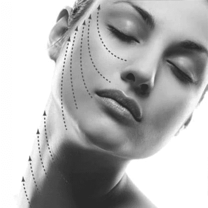 Woman With PDO Threads
